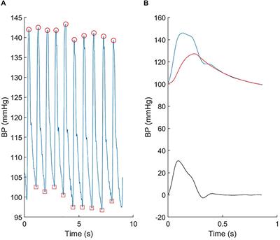 Feasibility of Estimation of Aortic Wave Intensity Using Non-invasive Pressure Recordings in the Absence of Flow Velocity in Man